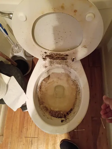 Toilet bowl before cleaning